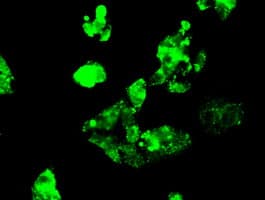 KIND2 / FERMT2 Antibody (clone OTI14A11)