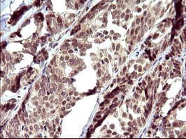 Monoclonal Mouse anti-Human UPRT Antibody (clone OTI1C9, IHC, WB)