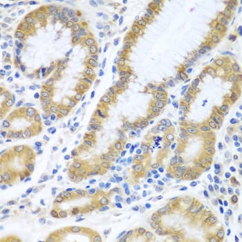 SIRT3 / Sirtuin 3 Antibody