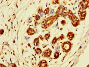 SDCBP2 / Syntenin 2 Antibody