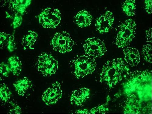 PathPlus™ Monoclonal Mouse anti-Human KRT18 / CK18 / Cytokeratin 18 Antibody (clone RCK106, IHC, WB)