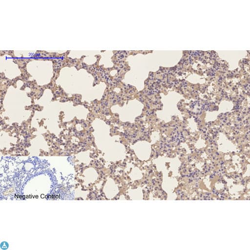 EP300 / p300 Antibody