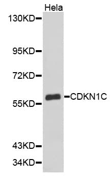 Polyclonal Rabbit anti-Human CDKN1C / p57 Kip2 Antibody (IHC, WB)