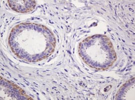 PADI4 / PAD4 Antibody (clone OTI5C10)