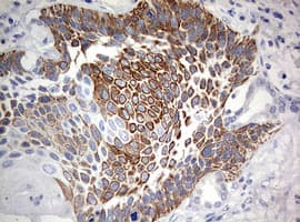 MAATS1 Antibody (aa1-313, clone OTI6G1)