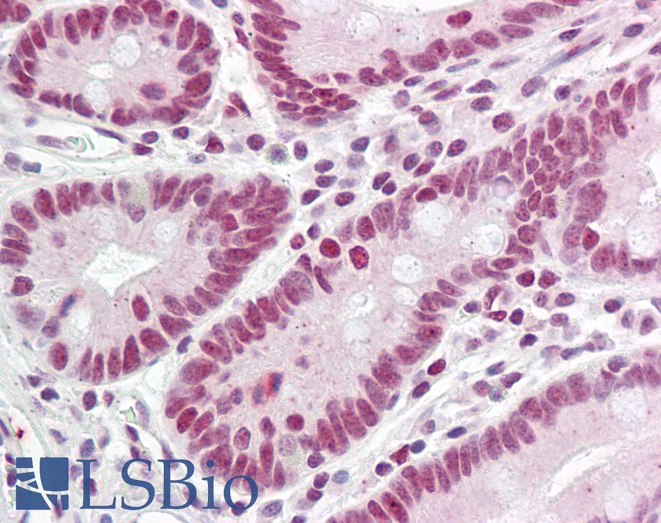 IHC-plus™ HNRNPL / hnRNP L Antibody (aa61-110)
