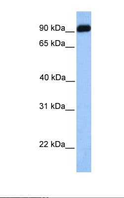 Polyclonal Rabbit anti-Human BMPER Antibody (aa501-550, IHC, WB)