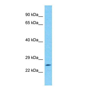 NPIPA5 Antibody (aa151-200)