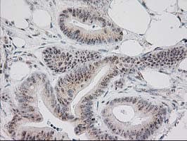 MGLL / Monoacylglycerol Lipase Antibody (clone OTI1C6)
