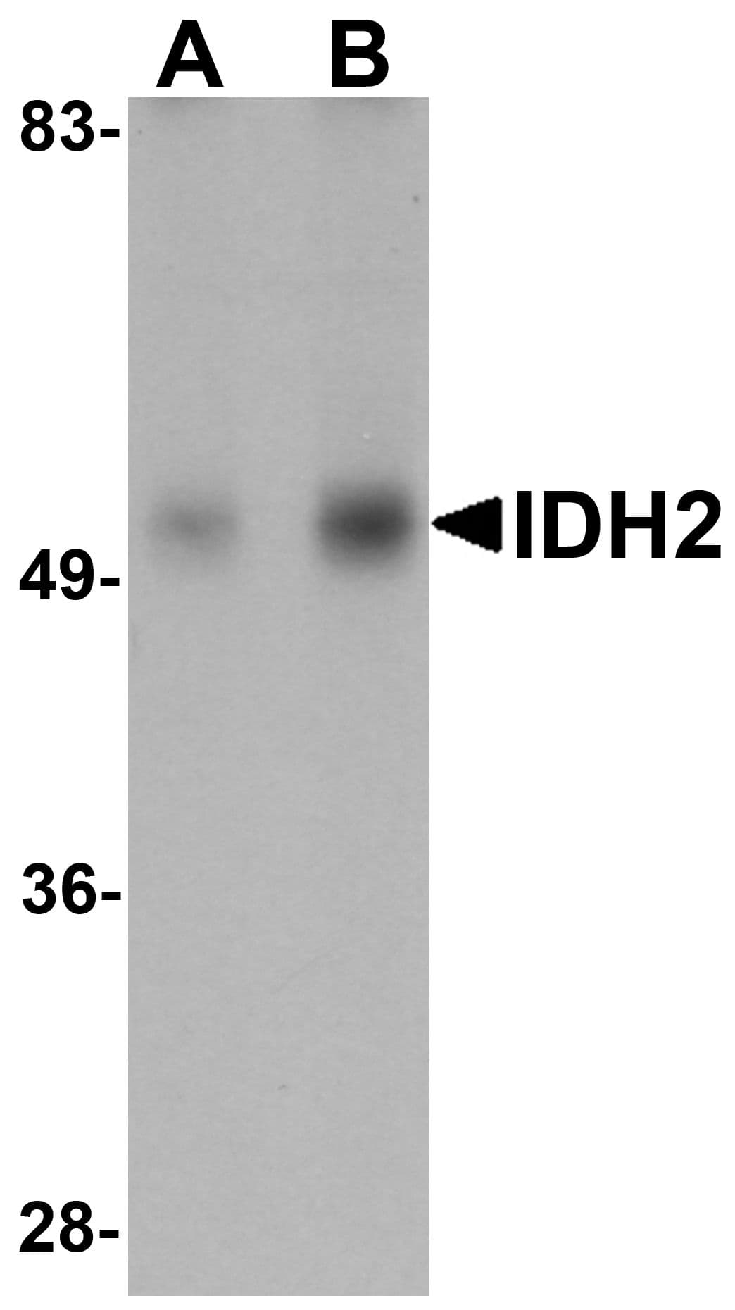 Polyclonal Rabbit anti-Human IDH2 Antibody (IHC, IF, WB)