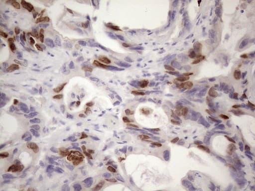 CDCA8 / Borealin Antibody (clone OTI4G3)