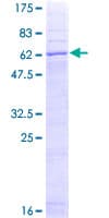 Human STEAP1 / STEAP Protein (Recombinant GST)