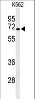 Polyclonal Rabbit anti-Human GPR50 Antibody (aa316-344, WB)