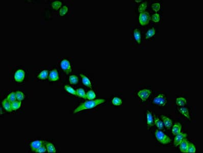 Polyclonal Rabbit anti-Human LYPLAL1 Antibody (IHC)
