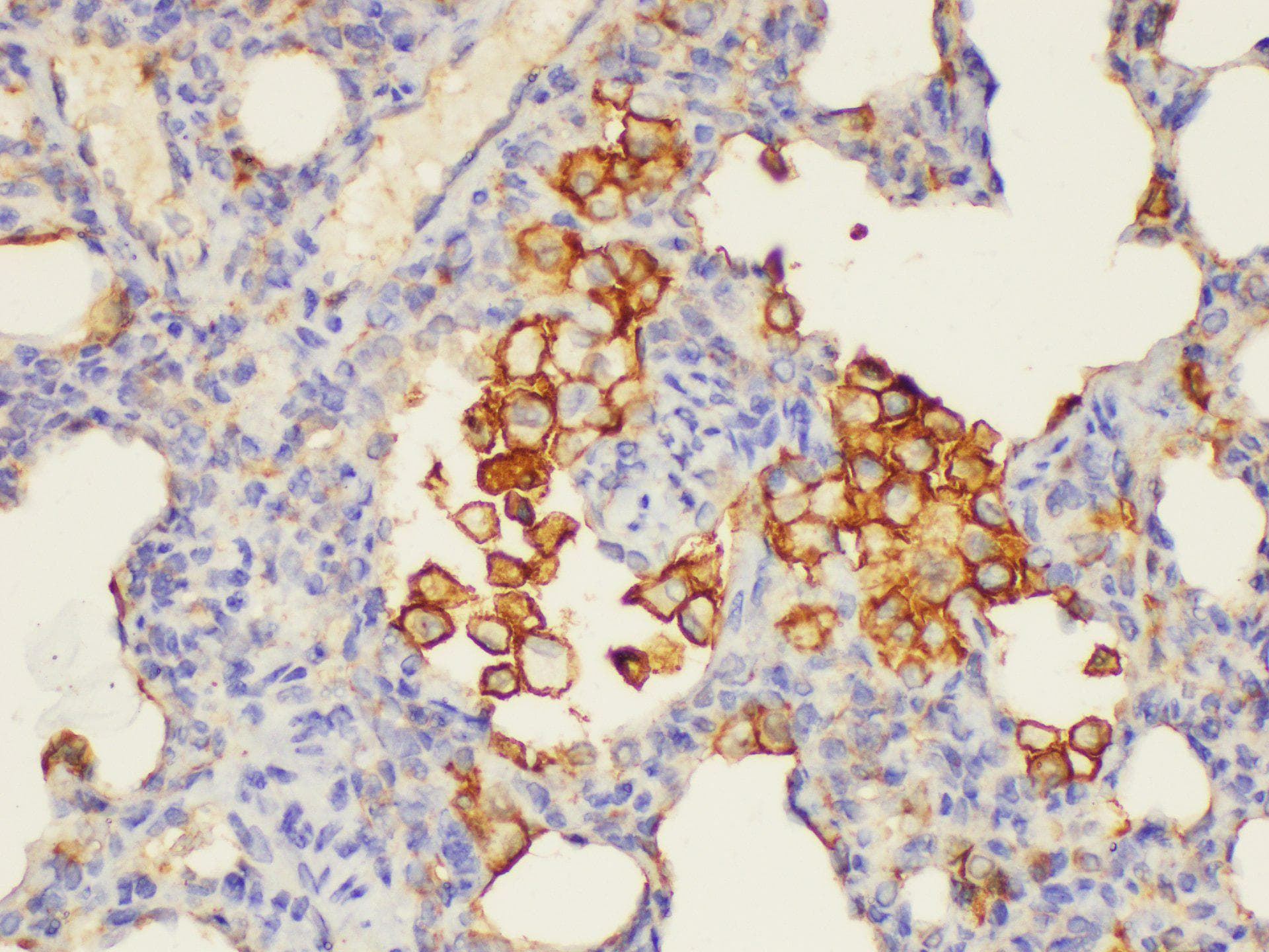 ANXA5 / Annexin V Antibody