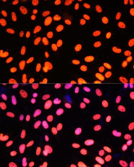 ZNF581 Antibody