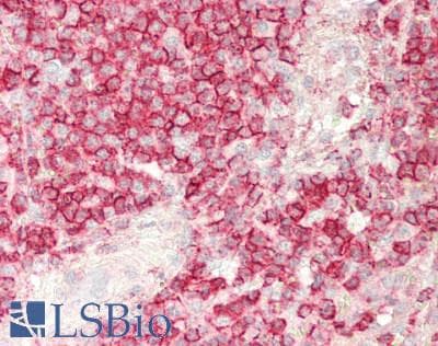 IHC-plus™ Polyclonal Rabbit anti-Human CD45 / LCA Antibody (aa336-364, IHC, WB)