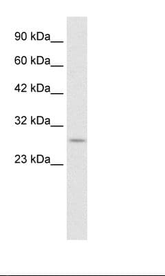 RNF141 Antibody (aa96-145)