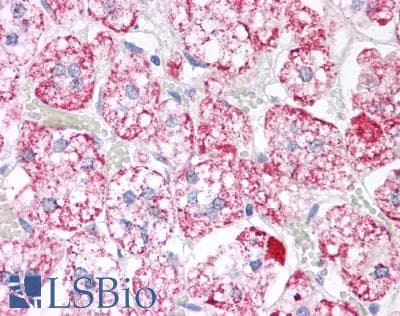 IHC-plus™ Polyclonal Rabbit anti-Human TOMM20 Antibody (aa20-145, IHC, IF, WB)
