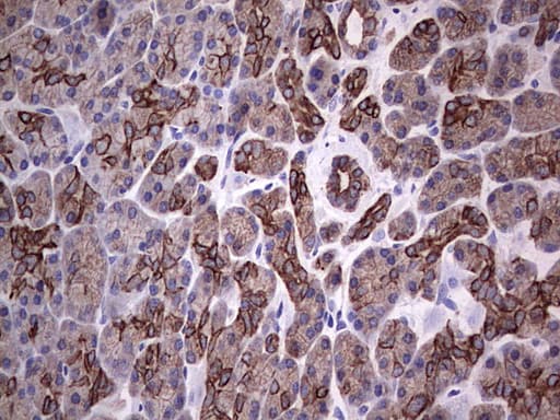 Acidic Cytokeratin Antibody (clone 8A3)