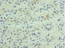 CSTF2 / CstF-64 Antibody (aa1-180)