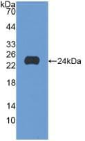 c-Kit / CD117 Antibody (aa321-520)