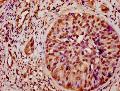 Polyclonal Rabbit anti-Human HIST1H3A Antibody (IHC, WB)