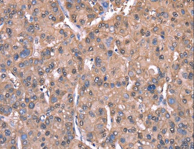 Polyclonal Rabbit anti-Human Spastin Antibody (IHC)