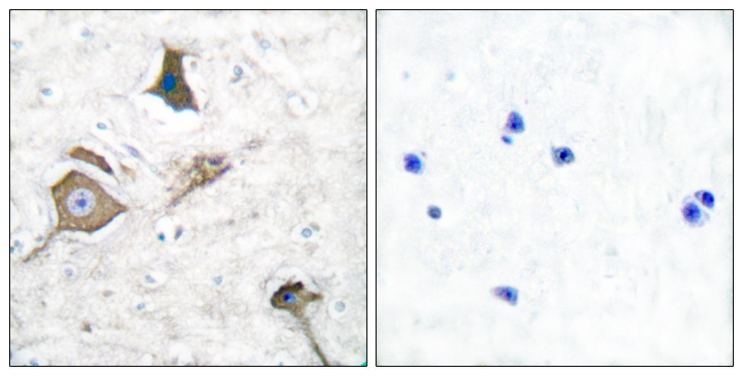 MMP16 Antibody