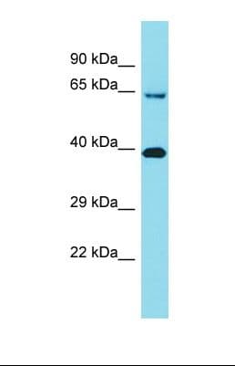 Polyclonal Rabbit anti-Human KIAA2013 Antibody (C-Terminus, WB)