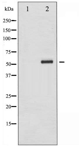 CHEK2 / CHK2 Antibody (phospho-Ser516)