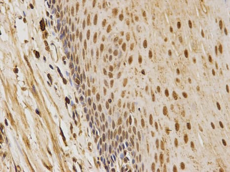 Polyclonal Rabbit anti-Human CDK4 Antibody (IHC, IF, WB)