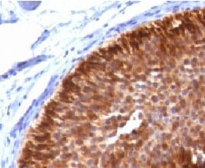 KRT17 / CK17 / Cytokeratin 17 Antibody (clone CTKN17-1, Ready-to-Use)
