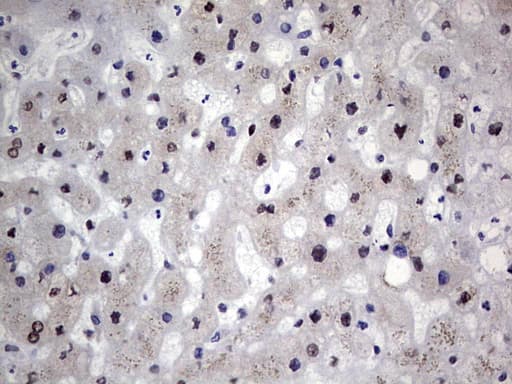 Monoclonal Mouse anti-Human RAD23B / HR23B Antibody (clone OTI7G10, aa1-253, IHC, WB)