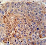 GPLD1 / GPIPLD Antibody (aa679-709)
