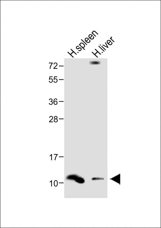 DEFA1 / Defensin Alpha 1 Antibody (Internal)
