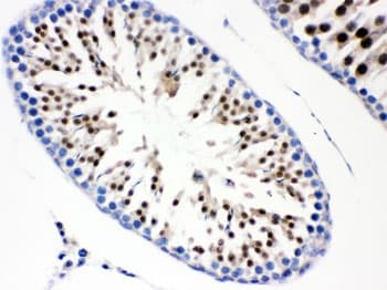 CDC6 Antibody