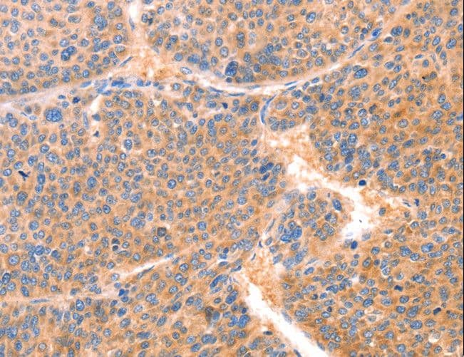 Polyclonal Rabbit anti-Human PRDX2 / Peroxiredoxin 2 Antibody (IHC, WB)