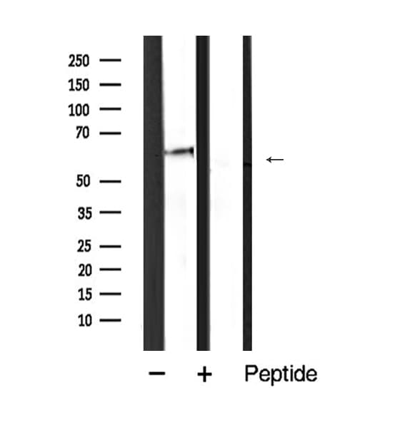 SQSTM1 Antibody