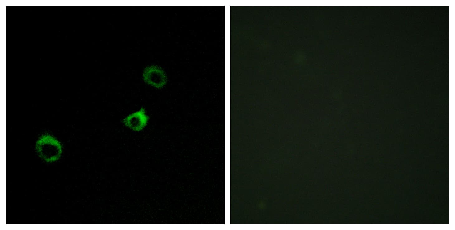 CYB561D1 Antibody (aa180-229)
