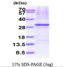 Human KLK10 / Kallikrein 10 Protein (Recombinant His)