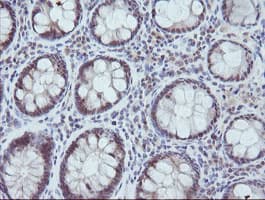 MAP2K3 / MEK3 / MKK3 Antibody (clone OTI3C8)