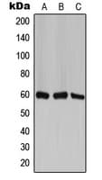Polyclonal Rabbit anti-Human CCT6A Antibody (Internal, WB)