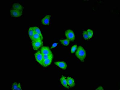 TOM1 Antibody