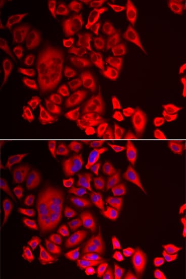 QPCT / QC Antibody