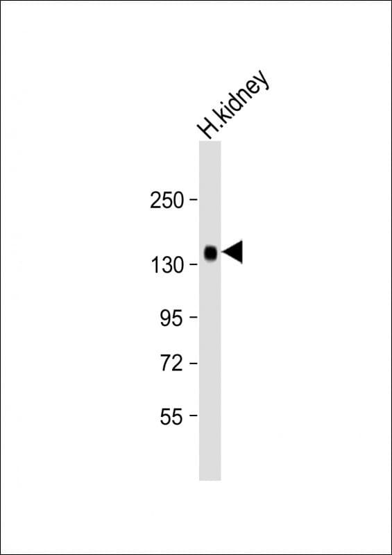 KL / Klotho Antibody (Internal)