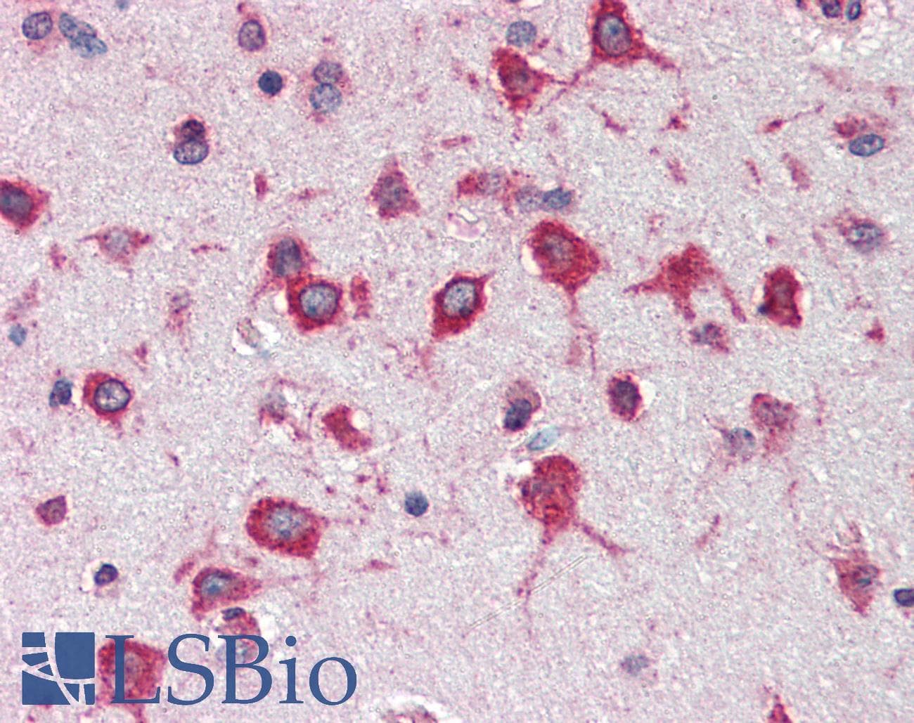 IHC-plus™ RPL8 / Ribosomal Protein L8 Antibody (aa181-195)