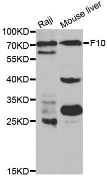 Polyclonal Rabbit anti-Human F10 / Factor X Antibody (IF, WB)