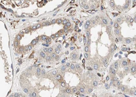 NFKBIA / IKB Alpha / IKBA Antibody (phospho-Tyr305)