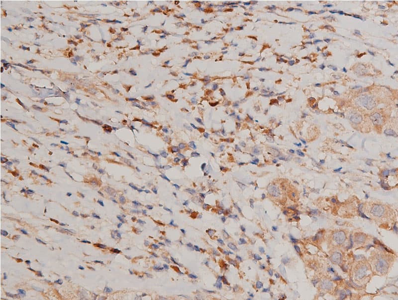 CHUK / IKKA / IKK Alpha Antibody (phospho-Ser176,pSer177)